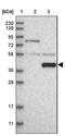 Cellular Communication Network Factor 1 antibody, NBP1-86573, Novus Biologicals, Western Blot image 