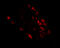 Mex-3 RNA Binding Family Member D antibody, 4835, ProSci, Immunofluorescence image 
