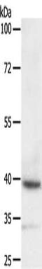 Deltex E3 Ubiquitin Ligase 3 antibody, CSB-PA026205, Cusabio, Western Blot image 