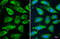 YTH N6-Methyladenosine RNA Binding Protein 2 antibody, GTX636775, GeneTex, Immunofluorescence image 