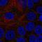 Epithelial Cell Adhesion Molecule antibody, HPA067463, Atlas Antibodies, Immunofluorescence image 