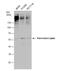 Pancreatic Lipase antibody, NBP1-32789, Novus Biologicals, Western Blot image 
