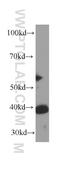 Stomatin-like protein 2 antibody, 60052-1-Ig, Proteintech Group, Western Blot image 