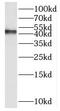 PAK1 Interacting Protein 1 antibody, FNab06121, FineTest, Western Blot image 