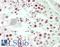 Centromere Protein H antibody, LS-B14483, Lifespan Biosciences, Immunohistochemistry paraffin image 