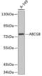 ATP Binding Cassette Subfamily G Member 8 antibody, 18-361, ProSci, Western Blot image 