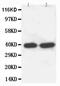 Solute Carrier Family 10 Member 1 antibody, PA1238, Boster Biological Technology, Western Blot image 