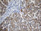 Carbonyl Reductase 4 antibody, M07359, Boster Biological Technology, Immunohistochemistry paraffin image 