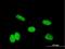 Homeobox A11 antibody, H00003207-M07, Novus Biologicals, Immunocytochemistry image 