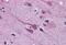 Gastrulation Brain Homeobox 2 antibody, GTX89212, GeneTex, Immunohistochemistry paraffin image 