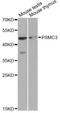 Proteasome 26S Subunit, ATPase 3 antibody, MBS129431, MyBioSource, Western Blot image 