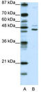 Jumonji Domain Containing 4 antibody, TA345373, Origene, Western Blot image 