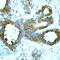 P21 (RAC1) Activated Kinase 1 antibody, STJ22326, St John