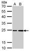 HRas Proto-Oncogene, GTPase antibody, TA308498, Origene, Western Blot image 