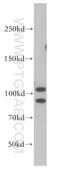 Staphylococcal Nuclease And Tudor Domain Containing 1 antibody, 10760-1-AP, Proteintech Group, Western Blot image 