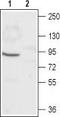 Cyclic Nucleotide Gated Channel Alpha 1 antibody, TA328963, Origene, Western Blot image 