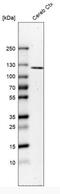 Extracellular Leucine Rich Repeat And Fibronectin Type III Domain Containing 2 antibody, NBP1-90569, Novus Biologicals, Western Blot image 