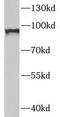 Signal Transducer And Activator Of Transcription 1 antibody, FNab08295, FineTest, Western Blot image 