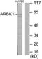 G Protein-Coupled Receptor Kinase 2 antibody, TA326219, Origene, Western Blot image 
