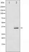 Cyclin Dependent Kinase 2 antibody, TA325343, Origene, Western Blot image 