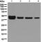 Methionine Adenosyltransferase 1A antibody, ab129176, Abcam, Western Blot image 