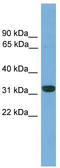 Homeobox protein CDX-4 antibody, TA341751, Origene, Western Blot image 