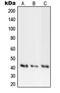 PKAc alpha antibody, MBS821533, MyBioSource, Western Blot image 