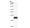 Histidyl-TRNA Synthetase antibody, LS-C342343, Lifespan Biosciences, Western Blot image 