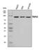 Thyroid Hormone Receptor Interactor 10 antibody, A03963-1, Boster Biological Technology, Western Blot image 