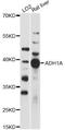 Alcohol Dehydrogenase 1A (Class I), Alpha Polypeptide antibody, LS-C749683, Lifespan Biosciences, Western Blot image 