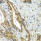 Cell Division Cycle 16 antibody, LS-C346277, Lifespan Biosciences, Immunohistochemistry paraffin image 