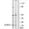 Coatomer Protein Complex Subunit Zeta 1 antibody, A07977, Boster Biological Technology, Western Blot image 