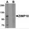 Zinc Finger MIZ-Type Containing 1 antibody, MBS151128, MyBioSource, Western Blot image 