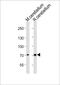 LEO1 Homolog, Paf1/RNA Polymerase II Complex Component antibody, PA5-49415, Invitrogen Antibodies, Western Blot image 