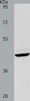 Plasminogen Activator, Tissue Type antibody, TA321238, Origene, Western Blot image 