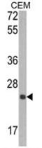 TIMP Metallopeptidase Inhibitor 1 antibody, AP17789PU-N, Origene, Western Blot image 