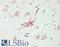 Glucosylceramidase Beta antibody, LS-B14503, Lifespan Biosciences, Immunohistochemistry paraffin image 