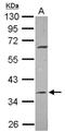 Methyltransferase Like 2B antibody, NBP2-17282, Novus Biologicals, Western Blot image 