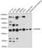 Terminal Nucleotidyltransferase 5A antibody, GTX64981, GeneTex, Western Blot image 