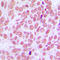 Coiled-Coil Domain Containing 102B antibody, LS-C354195, Lifespan Biosciences, Immunohistochemistry frozen image 
