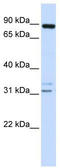 Disintegrin and metalloproteinase domain-containing protein 19 antibody, TA338633, Origene, Western Blot image 
