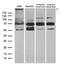 Dicer 1, Ribonuclease III antibody, TA890110, Origene, Western Blot image 