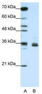 Heterogeneous Nuclear Ribonucleoprotein A1 Like 2 antibody, TA345729, Origene, Western Blot image 