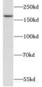 Cullin 7 antibody, FNab02081, FineTest, Western Blot image 