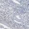 Melanocyte Inducing Transcription Factor antibody, NBP1-88618, Novus Biologicals, Immunohistochemistry frozen image 