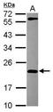 M-Phase Phosphoprotein 6 antibody, GTX115368, GeneTex, Western Blot image 
