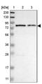 Myotubularin 1 antibody, NBP1-86113, Novus Biologicals, Western Blot image 