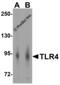 Toll Like Receptor 4 antibody, 3141, ProSci Inc, Western Blot image 