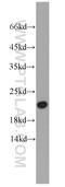 Calmodulin Like 6 antibody, 22274-1-AP, Proteintech Group, Western Blot image 