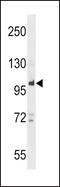 Protein Tyrosine Phosphatase Non-Receptor Type 22 antibody, 58-674, ProSci, Western Blot image 